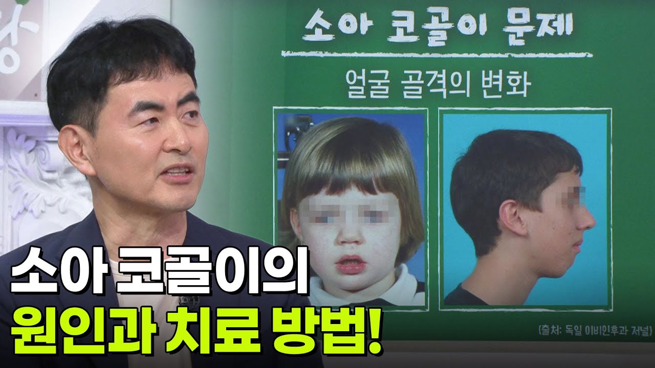 소아 코골이의 원인과 치료 방법!