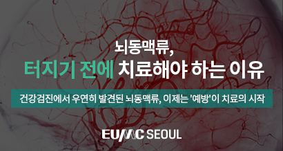 뇌동맥류, 터지기 전에 치료해야 하는 이유